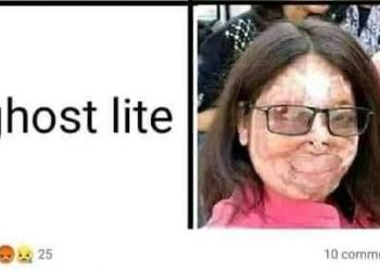 অ্যাসিড আক্রান্ত মহিলার ছবি নিয়ে বিকৃত মিম, জঘন্য মানসিকতার বিরুদ্ধে আওয়াজ ফেসবুকে!