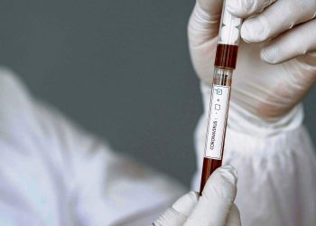 এবার বাংলার দ্বারস্থ ‘হু’, দক্ষিণ ২৪ পরগণায় তৈরি হল সবচেয়ে সুলভ ‘করোনা টেস্টিং কিট’