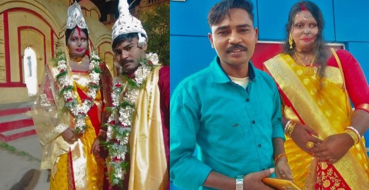 Daily News Reel - Acid Victim Sunita Get Married