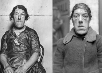 ‘কুৎসিত’ তকমার আড়ালে লুকিয়ে এক মায়ের সংসার টানার যুদ্ধ!