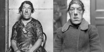 ‘কুৎসিত’ তকমার আড়ালে লুকিয়ে এক মায়ের সংসার টানার যুদ্ধ!